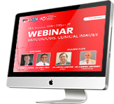 Sarcoidosis Clinical Images